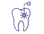 Corticobasal Implants